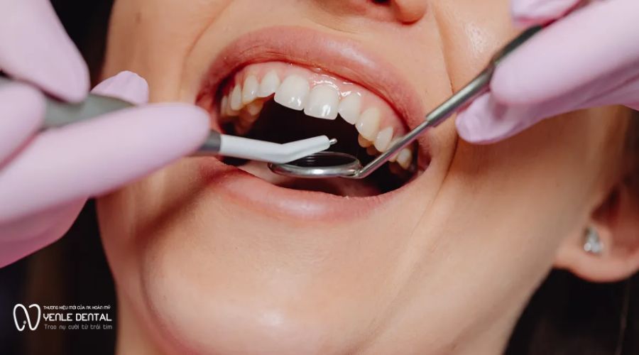 theo dõi tái khám định kỳ